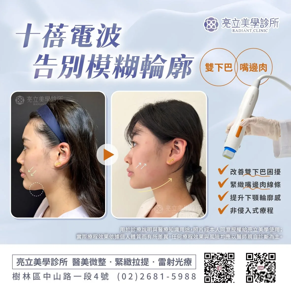 十蓓電波